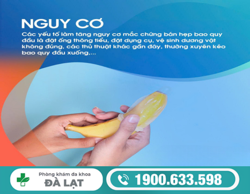 Hình ảnh minh họa